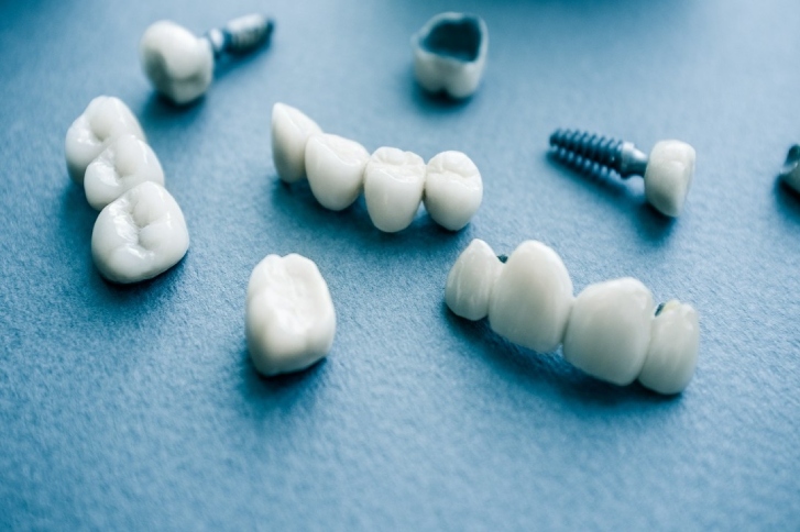 implanty zębowe ceramiczne